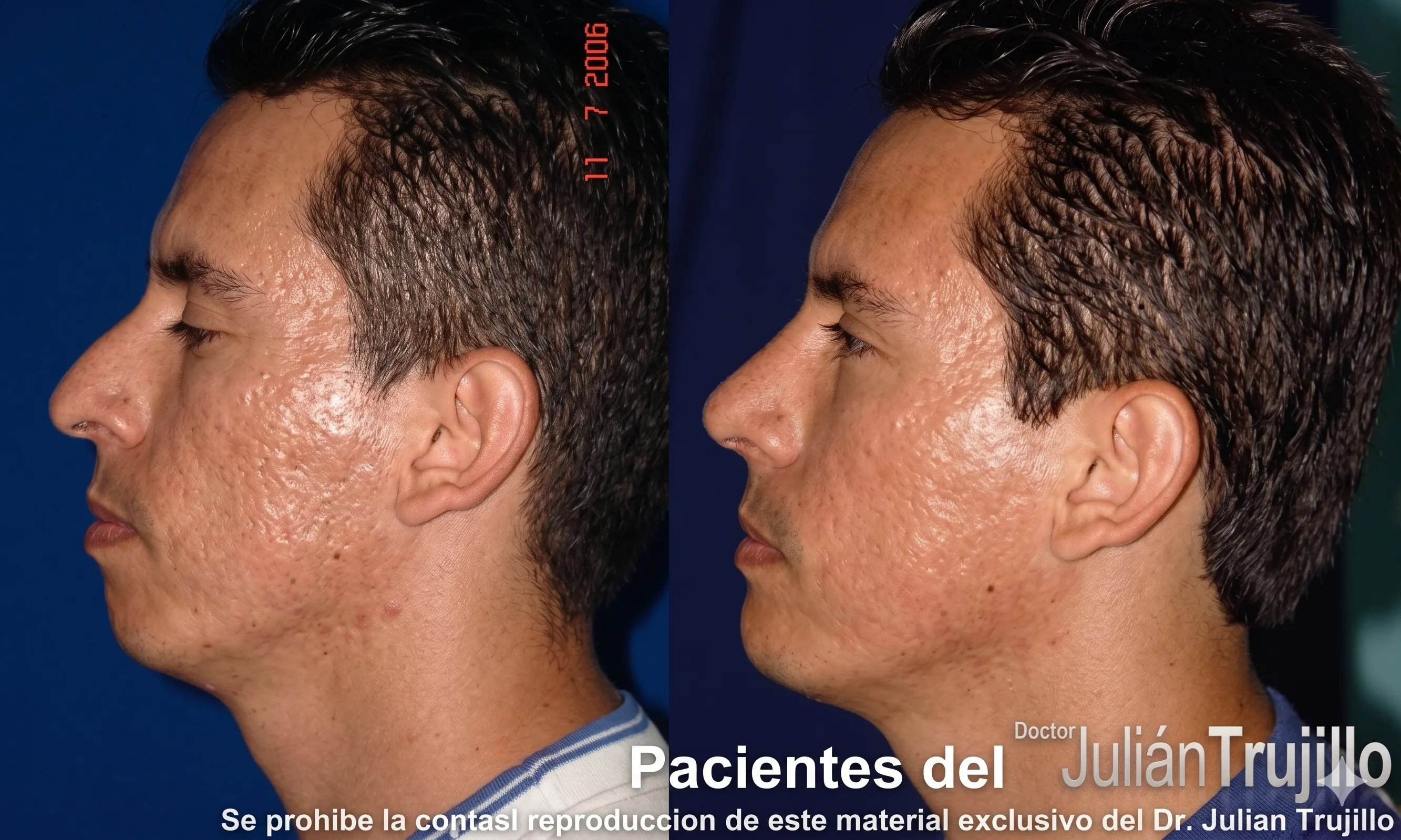 Before & After 2