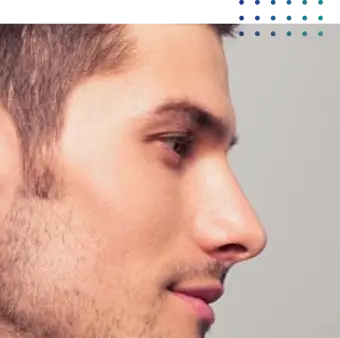 Rinoplastia Masculina